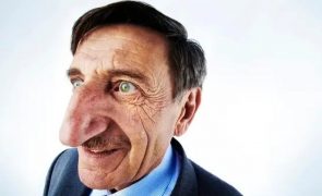 Homem com nariz mais comprido do mundo morre repentinamente