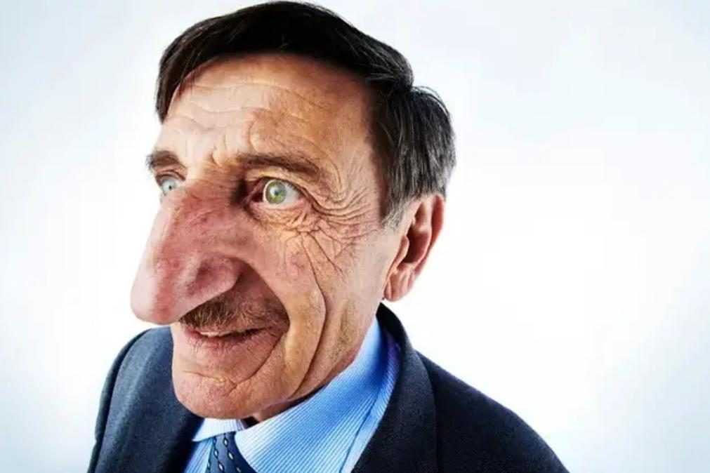 Homem com nariz mais comprido do mundo morre repentinamente