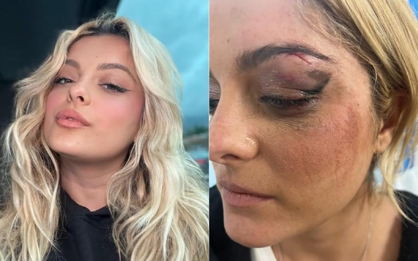 Bebe Rexha - Cantora termina concerto depois de ser agredida por fã