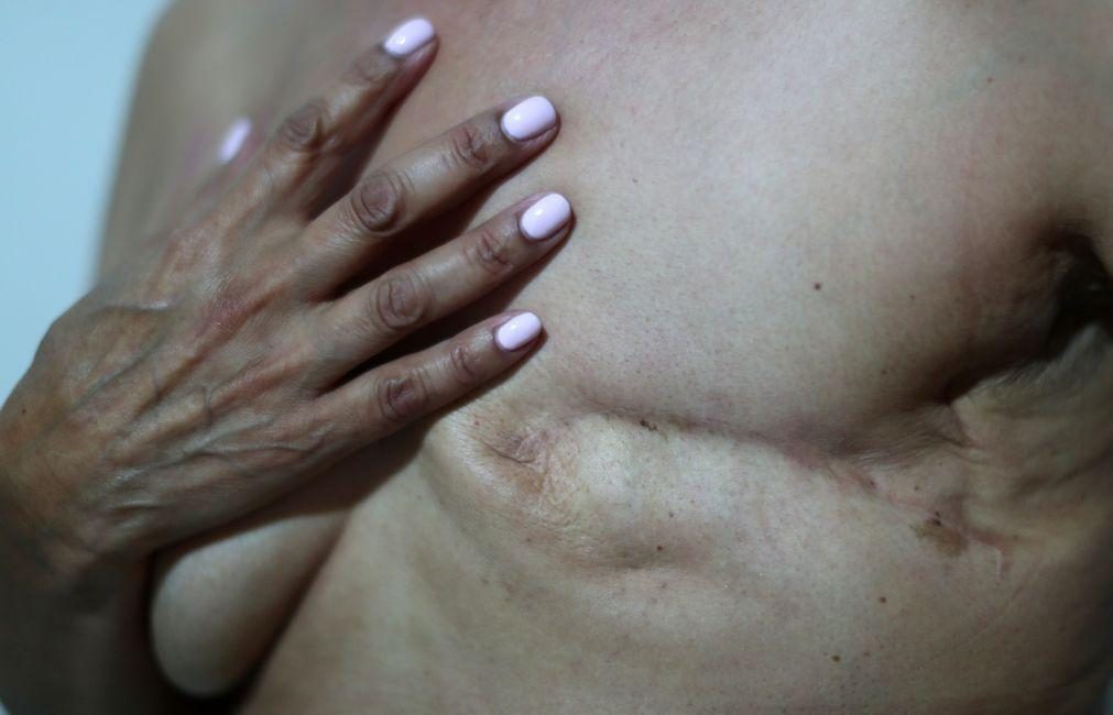 Programa de Rastreio do Cancro da Mama reforçado com mais de 59 MEuro até 2027