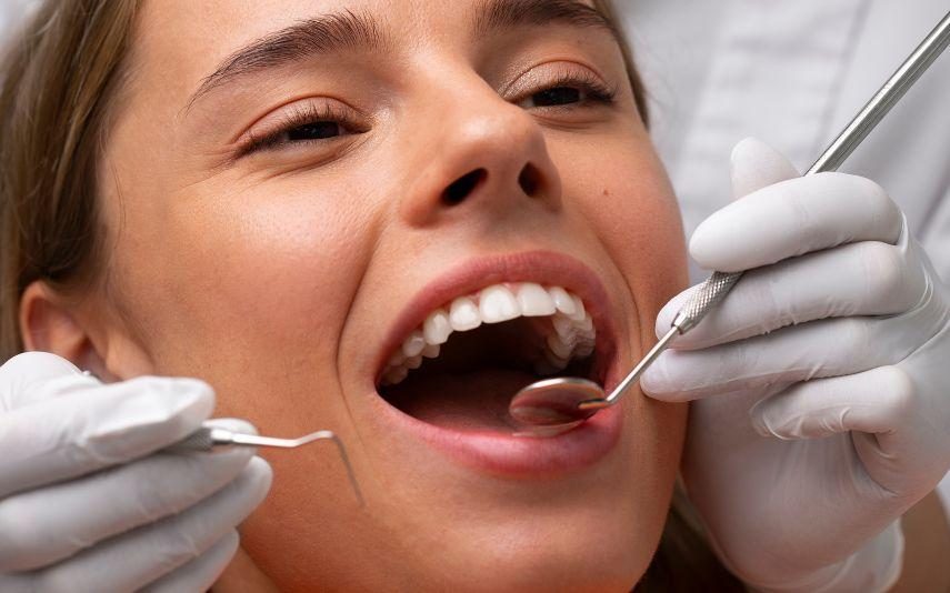 Check-up dentário  - O que é e a sua importância no mês da saúde oral