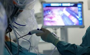Quase 5.000 cirurgias oncológicas que estavam à espera agendadas até 30 de abril