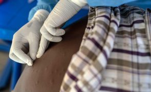 Espanha anuncia que vai doar 100 mil frascos de vacina contra mpox a países africanos