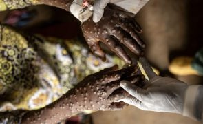 África regista 26.550 casos e 724 mortes devido à Mpox desde o início do ano