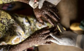 África registou quase 78.000 casos de Mpox e 1.321 mortes desde 2024