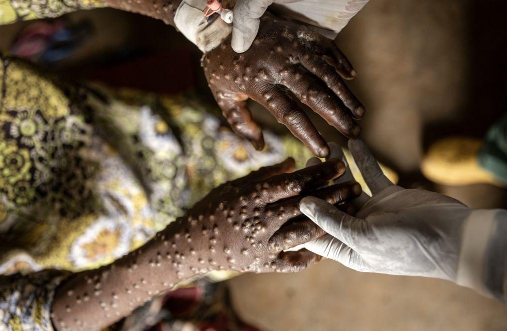 África registou quase 78.000 casos de Mpox e 1.321 mortes desde 2024