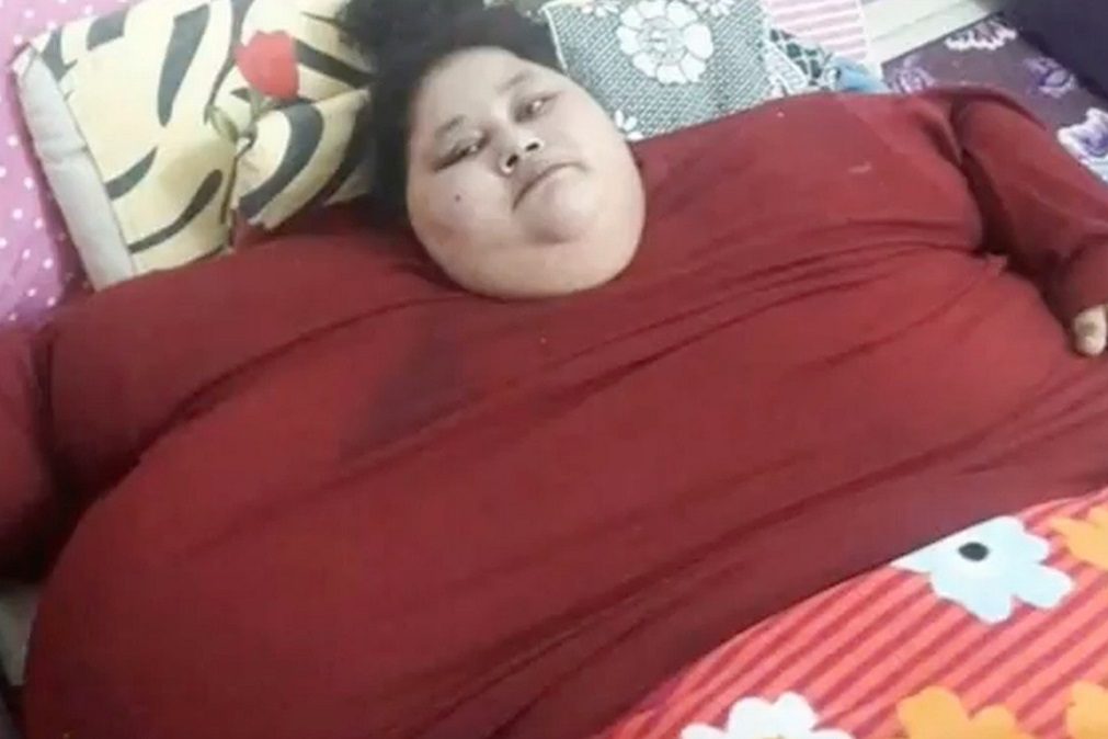 Mulher mais gorda do mundo perdeu 100 quilos