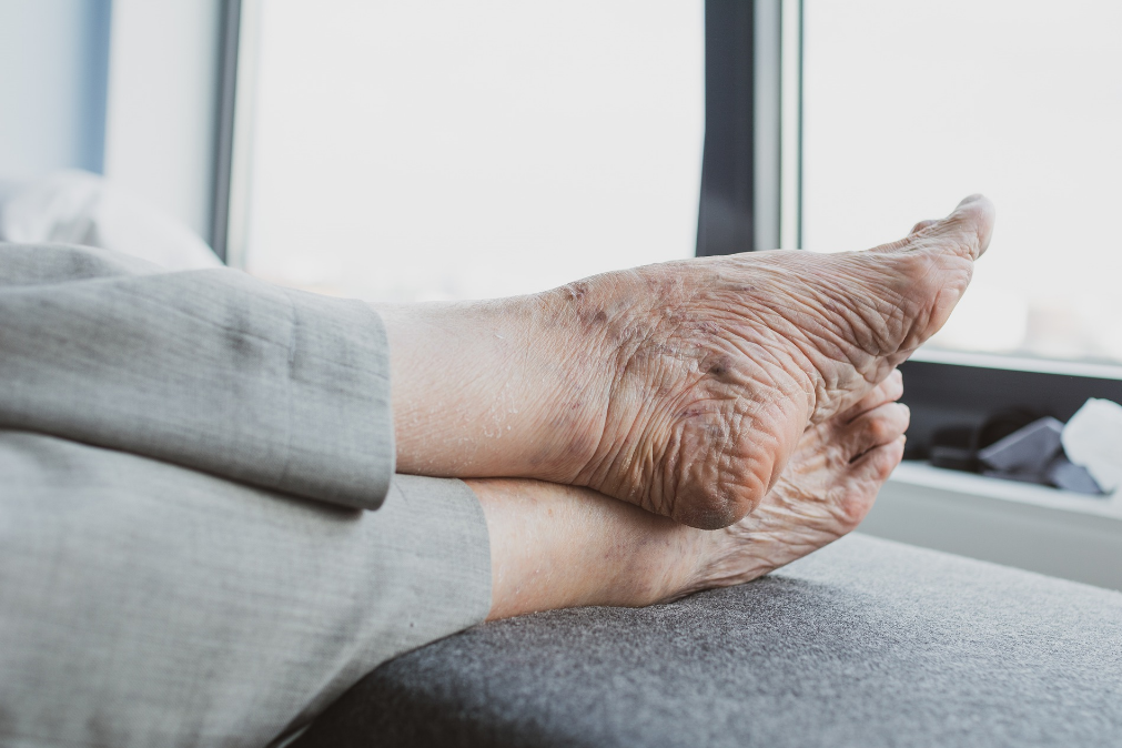 Como evitar traumas ou problemas anatómicos nos pés dos idosos