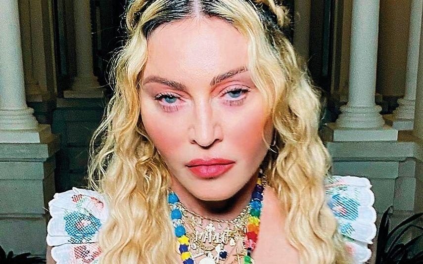 Madonna A nova cara da rainha da pop após cirurgias estéticas