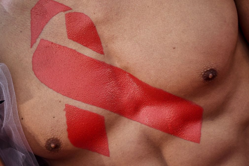 Mortes ligadas ao VIH/sida caem para quase metade em relação a 2005